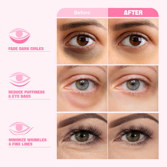 ZealSea 20 Pairs Under Eye Masks for Dark Circles Puffy Eyes and Wrinkle