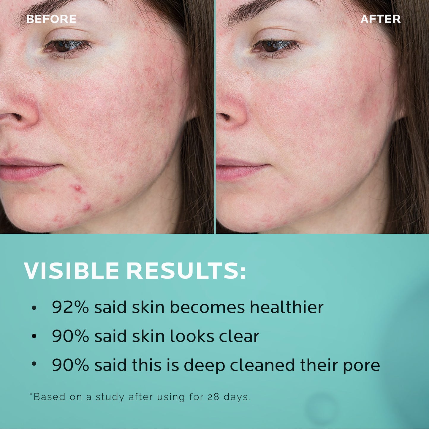 ZealSea 2% Salicylic Acid Toner for Face with 2% Niacinamide